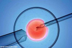 专业拉拉代怀助孕费用多少